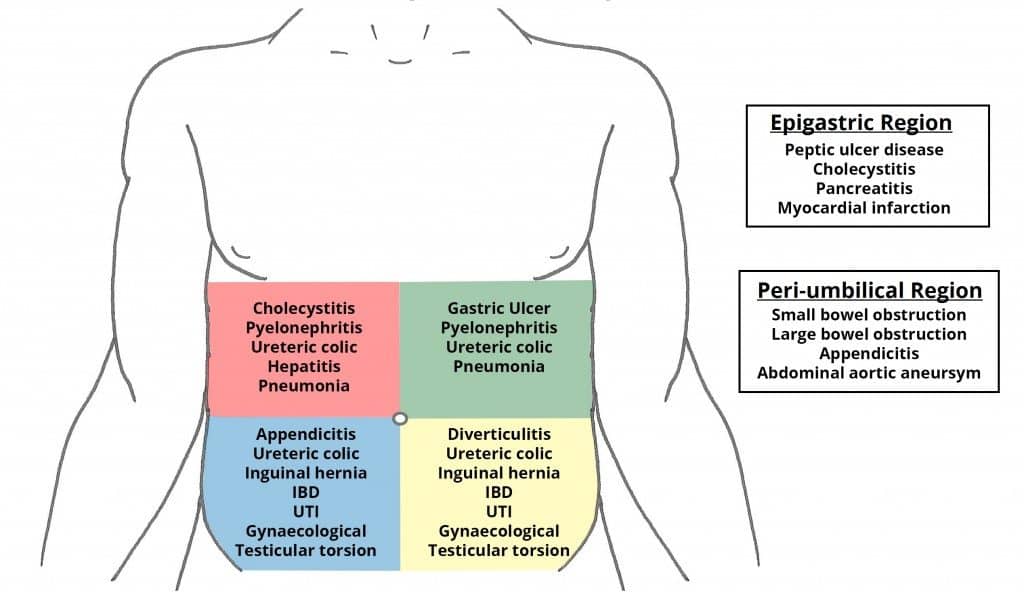 Fig 2 - Differential diagnoses for pain in each region of the abdomen.