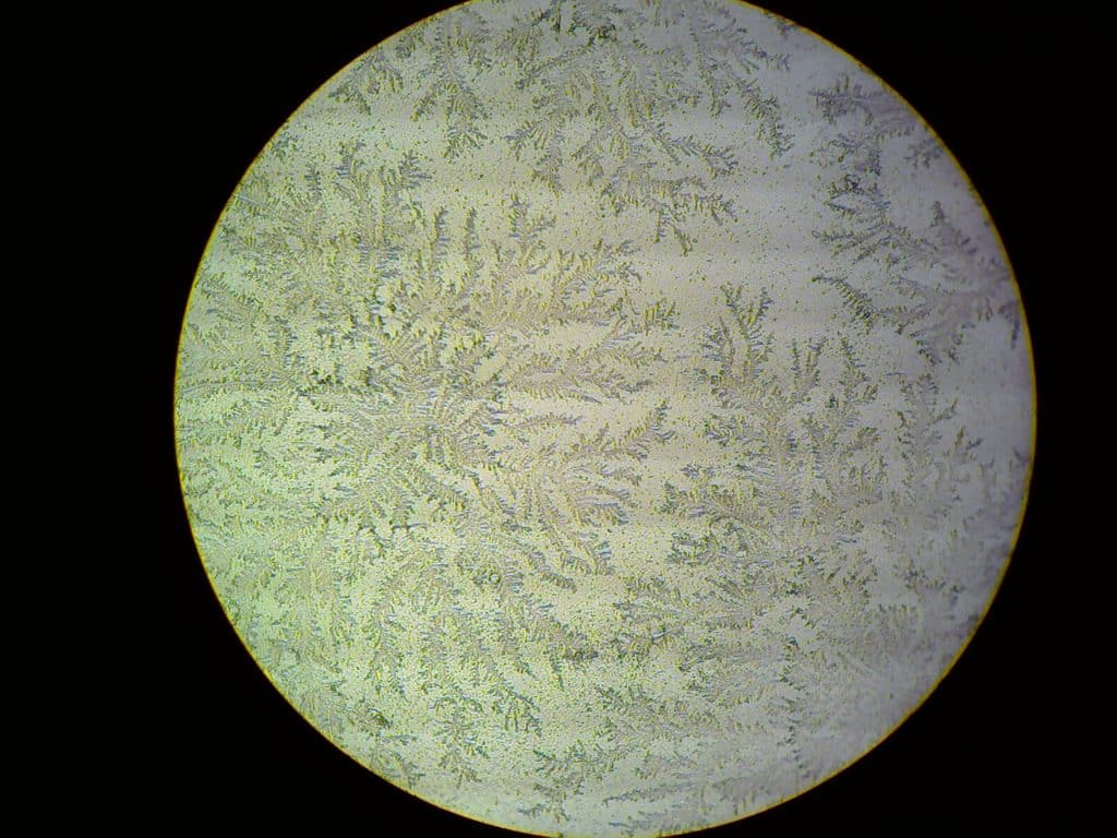 Fig 2 - A positive ferning test. Cervical secretions form fern-like crystals when left to dry on a glass slide.