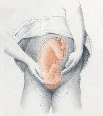 uterine presentation in pregnancy