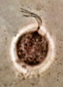 Figure 1. Trichomonas vaginalis microscopy.