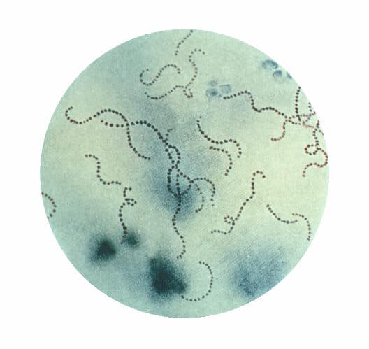 Chain formation of Streptococcus pyogenes bacteria, a leading cause of sepsis in pregnancy